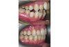 Orthognathic surgery