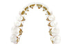Lingual Braces | Oldham | Manchester Orthodontics