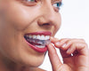 Clear Aligners | Invisalign® | Oldham Orthodontics