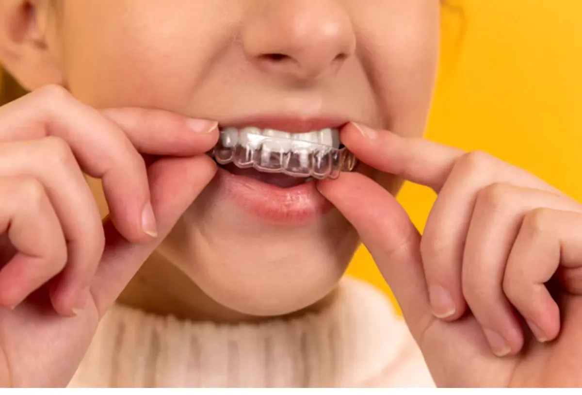 Can I Still Whiten My Teeth if I Have Invisalign?