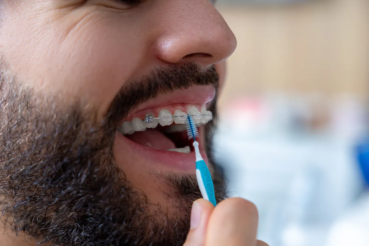 A confident patient mid-treatment with ceramic braces