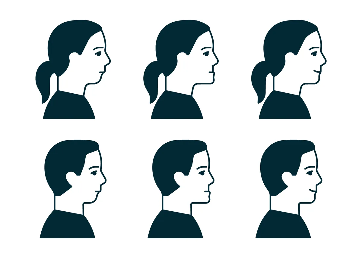 What are the Benefits of Orthognathic Surgery?