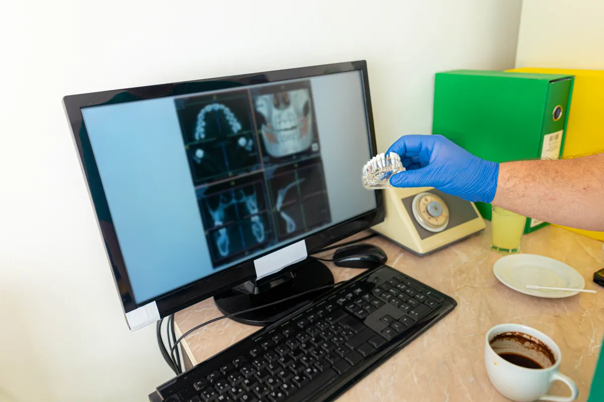 Detailed orthodontic planning
