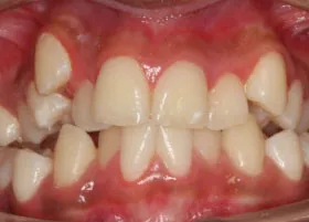 Before treatment