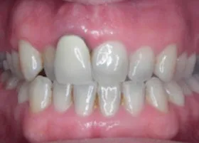 Before treatment