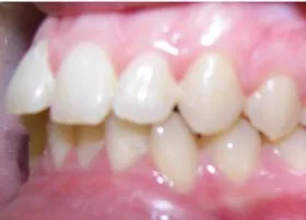 Before treatment