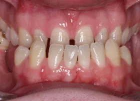 Before treatment