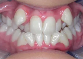 Before treatment