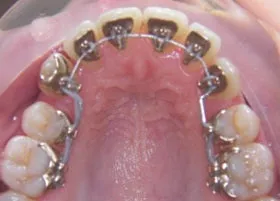 After treatment